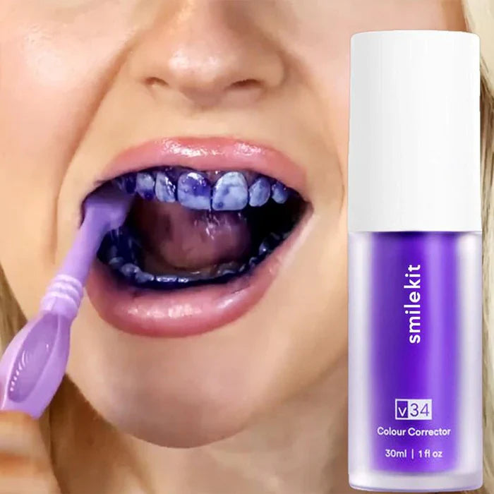 [Queima de Estoque🔥] Clareador Dentário WhitePlus™ - Sérum V34 + Brindes Exclusivos (Somente Hoje)