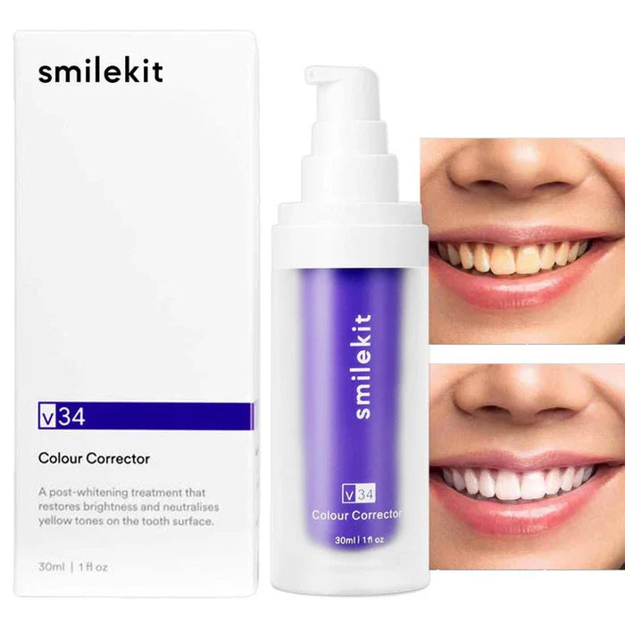 [Queima de Estoque🔥] Clareador Dentário WhitePlus™ - Sérum V34 + Brindes Exclusivos (Somente Hoje)